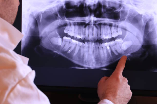 Best Emergency Dentist for Special Needs Patients in Guerneville, CA